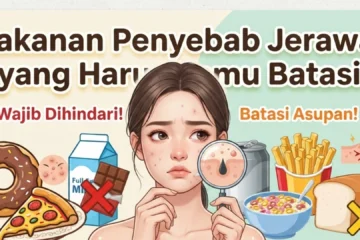 Makanan Penyebab Jerawat